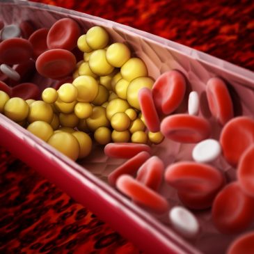 La mitad de la población adulta padece ya hipercolesterolemia: Colesterol I