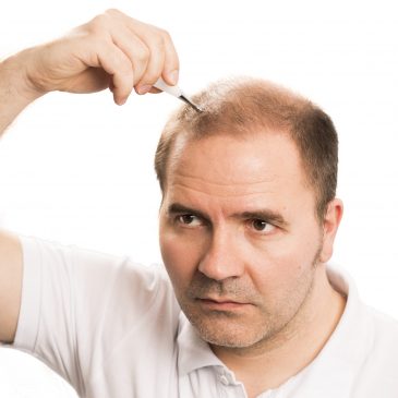 Medicamentos y complementos alimenticios que ayudan a frenar la caída del cabello