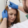 Mujer recibe tratamiento para detener la alopecia femenina